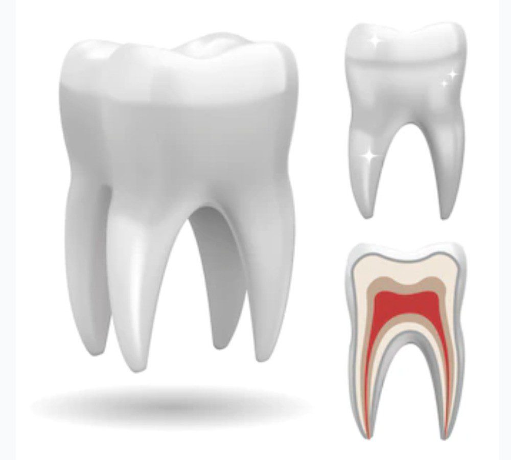 Los tipos de endodoncia determinan el precio