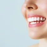 Mujer joven sonríe después de un tratamiento de estética dental