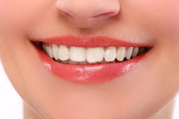 Gingivitis: el inicio de la pérdida dental